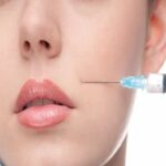 Thread Lift in Riyadh